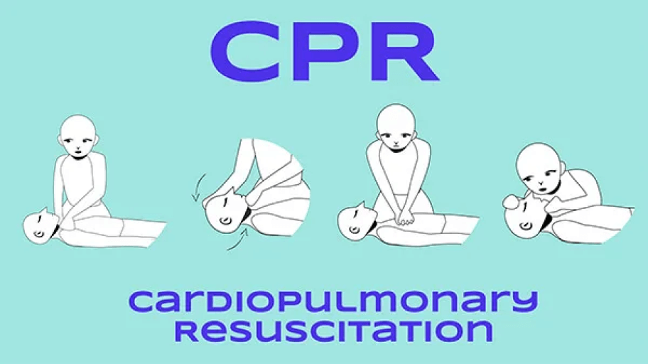 Drawing of the steps to do a CPR